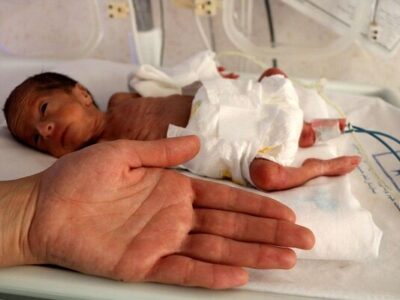 ترخیص نوزاد ۷۰۰ گرمی پس از ۴۸ روز تلاش شبانه‌روزی کادر درمان