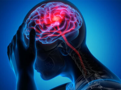 تحریک نخاع به بازیابی قدرت بازو پس از سکته مغزی کمک می کند