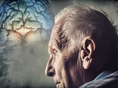 ارتباط سکته خفیف با افزایش ۳۴ درصدی زوال عقل در درازمدت